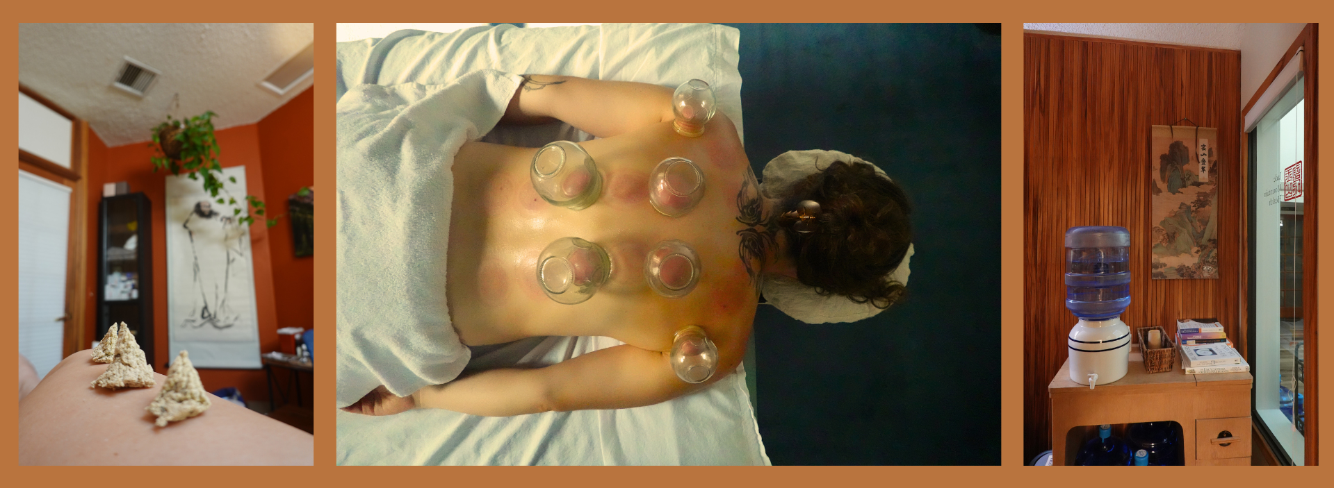 Acupuncture treatment room